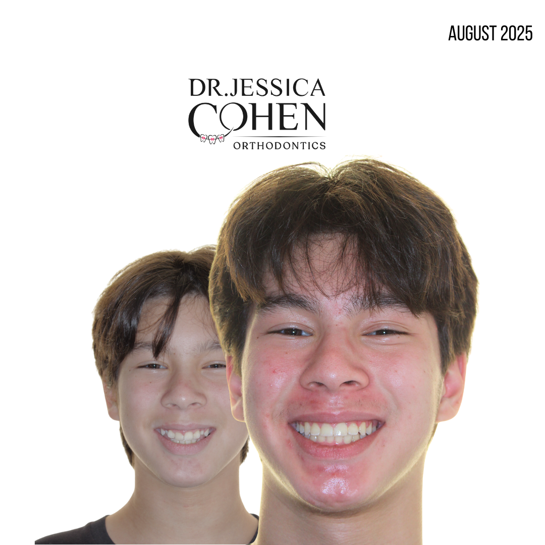 Young man with teeth smiling
